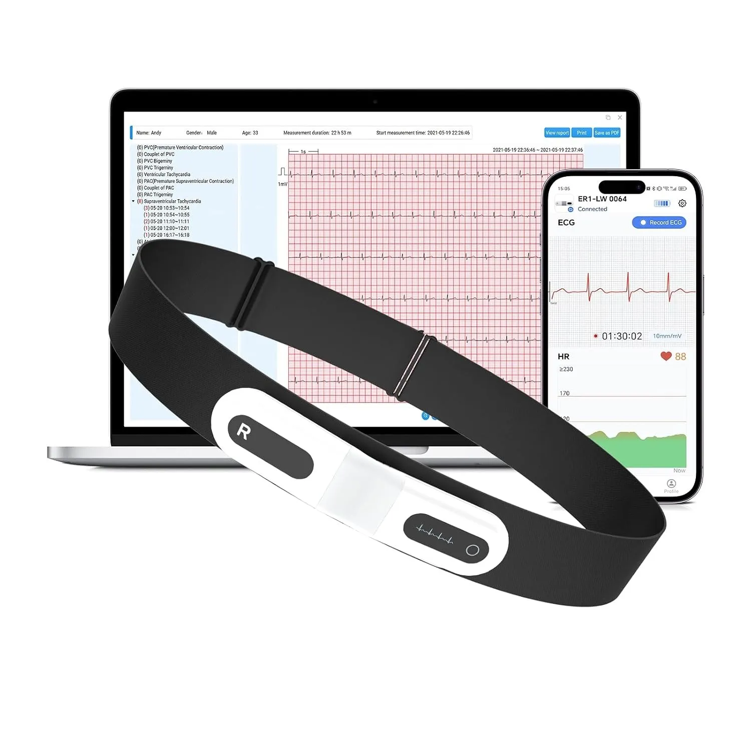 CheckMe ER1-LW 72 Stunden Langzeit-EKG Gerät mit AI-Analyse | EKG Gerät für Zuhause, EKG-Ereignismarker-Funktion, App &…